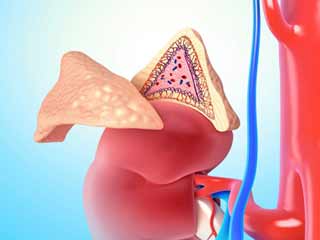 Pheochromocytoma Los Angeles