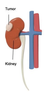 kidney doctor experts los angeles
