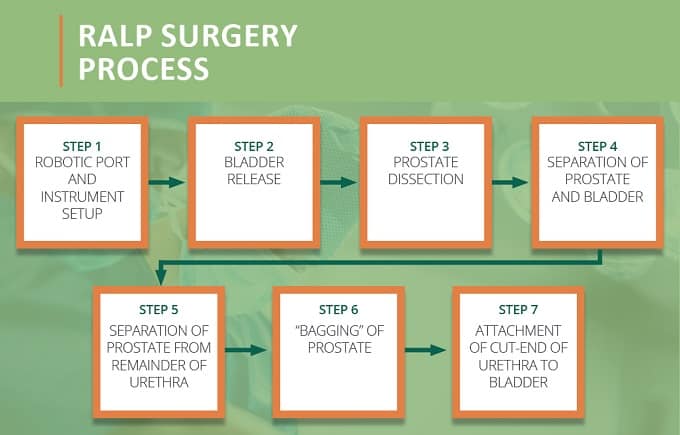 RALP Surgery Process Steps